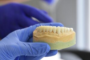 onetwothreedental1_The Benefits of Dental Implant Treatment