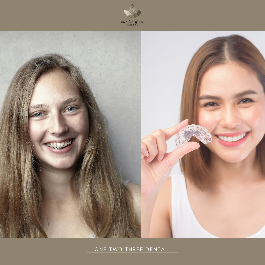 Braces vs. Aligners in Everyday Life: What Guiseley Patients Wish They Knew Before Choosing