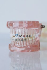 Aligners in Everyday Life