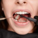 How Often Should You Get an Airflow Stain Removal Treatment?