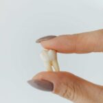 Pain-Free Root Canal